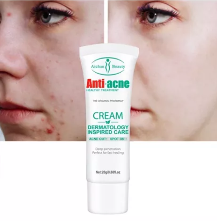 CREMA ANTI ACNE